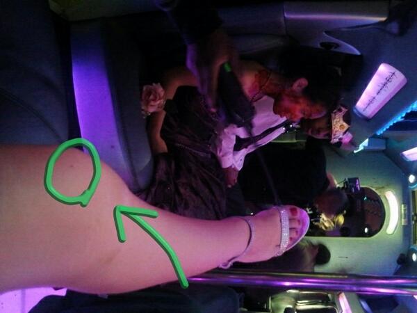 ILoveLevine's tweet image. I don't know how I'm going to get past this... I got blood on me!!!! #promride #onset