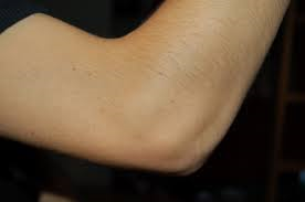 SteveLomasMFC's tweet photo. Neil Harris is away with Under 21s at the moment so Id like some advice, is this my arse or my elbow? #millwall #mfc http://t.co/ms2EWJu2Xf