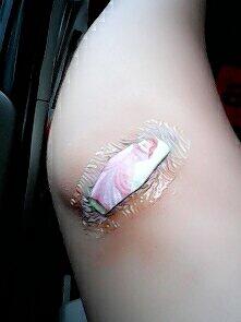 Cherrybellindo's tweet photo. GWS RT @officialcrysta: Ini sikut tangan kiri aku luka krn training kemarin yg guling2 ditanah aspal itu huhuhu T___T http://t.co/ho5idBdtlv