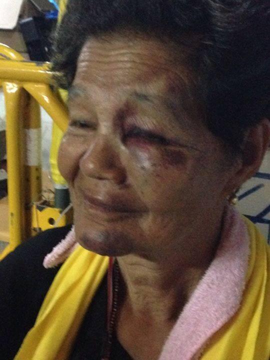 Rang70's tweet image. สงสารคุณป้าท่านนี้มากครับ ตำรวจไทยภูมิใจใหมครับ ทำร้ายผู้หญิงสูงวัยใด้ขนาดนี้ เพียงเขามาชุมนุมตามสิทธิที่มีในรธน.