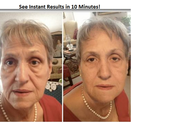 Want to Erase Wrinkles Fast? You Can! FREE Skincare Assessment!! Click here to begin tinyurl.com/k99nvuq