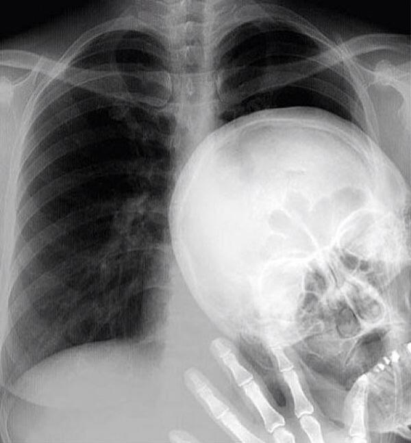 Afbeeldingsresultaat voor xray selfie