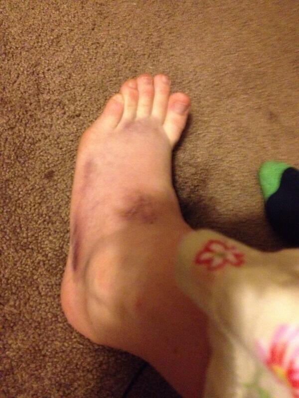 PipsSloth's tweet image. Gotta love being a clutz XD Buses are dangerous things to get off of :P