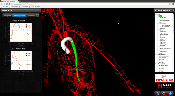 pauloziemer's tweet photo. @goXTK Hi, take a look at http://t.co/JKUGcGS0qH with arterial syst in 3D (xtk) and simulation of bood pressure/flow http://t.co/esJyofsqGi