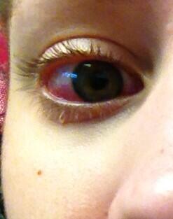 ah_nette_'s tweet photo. GT, WTF have you done to my eye??? #devilsspawn #finals #allnighter #SOS http://t.co/wKirnRFiRd
