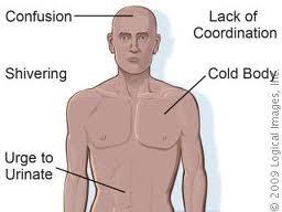 excursionout's tweet photo. Be prepared for Hypothermia http://t.co/ivOeQDQUpx http://t.co/DIsjrrBtdt