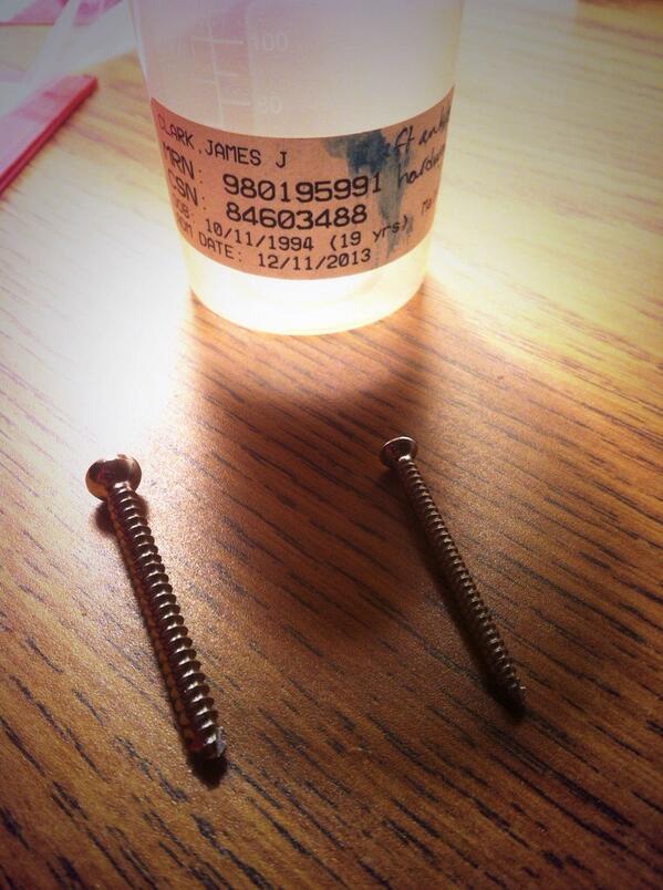 rontheroller's tweet image. &quot;@Jamesclark_94: These 2 are out of my ankle now 👌 http://t.co/EmwGVcSKfC&quot; #halfmanhalfmachine