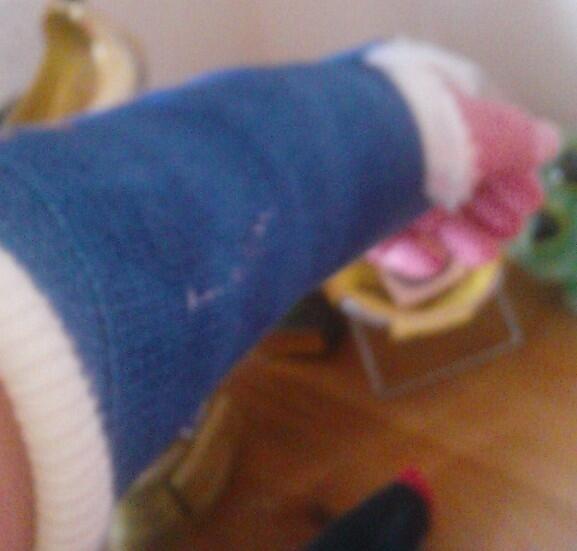 BenKillan's tweet photo. Uh oh, plastered for 4 weeks http://t.co/4XiaxQ5A8A