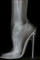 BetIQ_com_au's tweet photo. XRAY results of Stuart Broads injury have just come in.... http://t.co/jyg5M8srIP