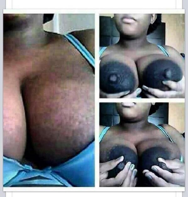 “<a href="/nowthatsafreak/">NowThatsAFreak</a>:  suck on them  @TYisThatNigga” some burned her when she was younger??