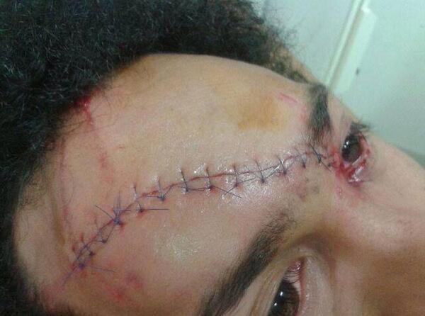 PasionPorRugby's tweet photo. #CariciasDelRugby

Richard Haughton de perpignan después de recibir un "golpecito" http://t.co/sratJAPntd