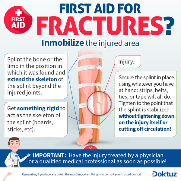 Doktuz's tweet photo. Learn how to #immobilize a #fracture and improvise a splint, so when that happens you will know what to do! Be well! http://t.co/CeKieyYOGj