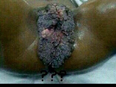 edoug0217's tweet image. If yo vagina look like this #LeaveMeTfAlone