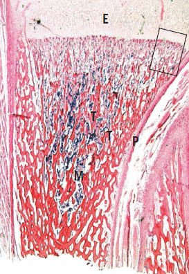 endochondral ossification histology