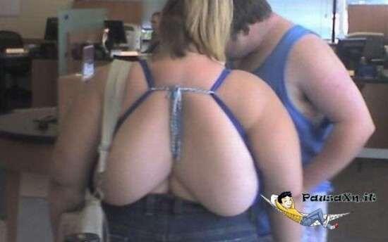 what_apity's tweet photo. Iniziamo con questo fantastico paio di tette dorsali http://t.co/xXygDuE3hr