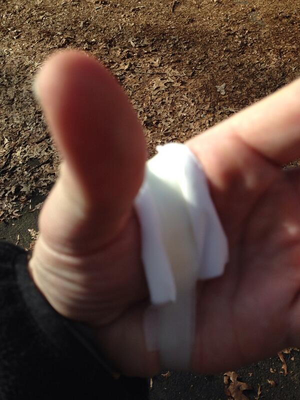 Damn oyster.  #2014firstinjury