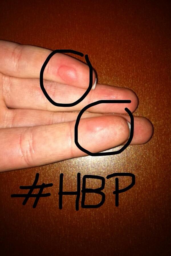 hballproblems tweet picture