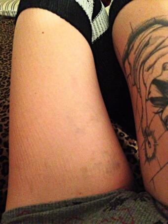 Sock lines and bruises. Time for a bowl. http://t.co/ATQuSMr2Ku<a href="/tag/manyvids"class="tags"><span>#manyvids</span></a><a href="/tag/mvsales"class="tags"><span>#mvsales</span></a>