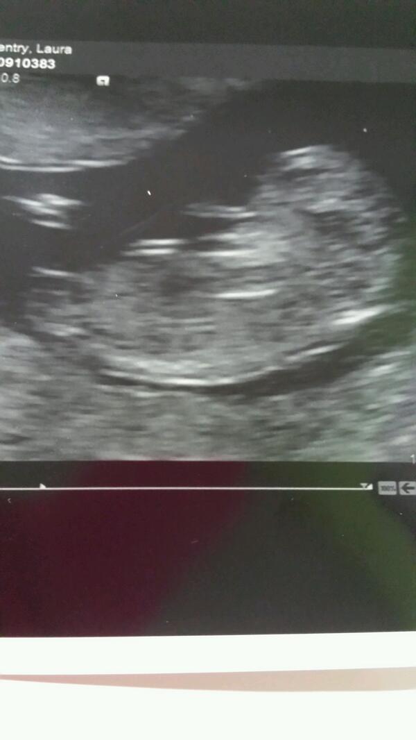 LauraCoventry2's tweet photo. My wee baba brown <3 http://t.co/DlBuk8cKjT