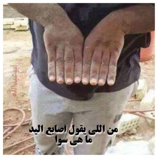 FAWAZALAJI's tweet photo. لكل قاعدة استثناء، فقد تكون أصابعك متساوية أحياناً!!!

#سبحان_الله 
#غريبة 
#عجيبة 
#فوتوشوب ؟ http://t.co/Eo6F80w3HG