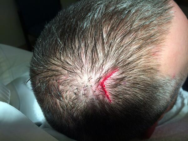 thejitzlife's tweet photo. Off the mats for a week!!!!!??? Boooooo #bjjproblems http://t.co/Q4NaMCOS3p