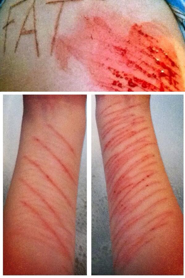 InsaneCutter's tweet image. thought id look through some of my old photos quickly,never thought id end up like this,every scar has a story right