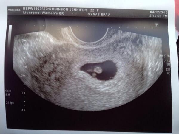 The best Christmas surprise congrats to my big bro and Jen <a href="/JenJenRobo/">Jen Robinson</a> <a href="/joel_symes/">Joel symes</a> #excited 😘😍