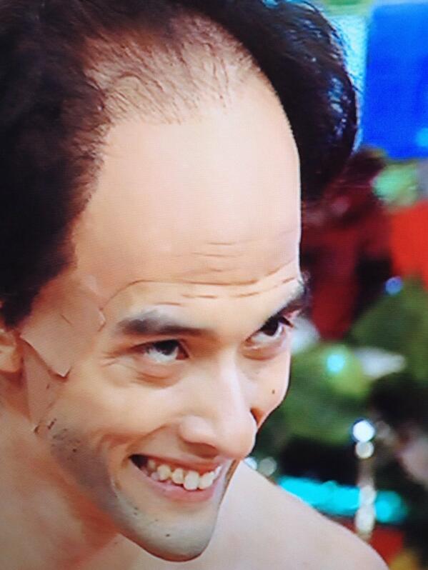 Miecchi 笑っていいとも たまたま見たけど栗原類突き抜けてたな エガちゃん本人よかある意味キワモノw Http T Co 8phxdhbsye Twitter