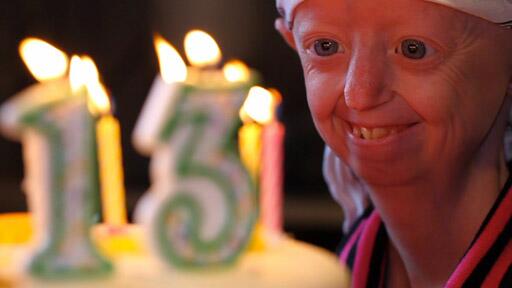 RipleyMX's tweet photo. Hayley Okines sufre progeria: Tiene sólo 13 años pero su cuerpo luce como de 104. ¡Aunque usted no lo crea! http://t.co/rkbtsZwMHw