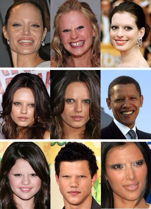 SandraLeeMD's tweet photo. See how important brows are? Did you know Latisse can thicken your over plucked brows?  #eyelashes #groweyebrows http://t.co/7xbmMycWzq