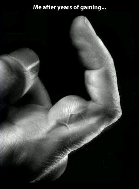 jari tangan gue nih karena kebanyakan maen game o_O