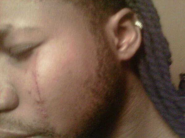 TonBoyIzz's tweet photo. Accidente mais pa mort jsui toujours laa #MerciSeigneur http://t.co/VkK6ii4UeG