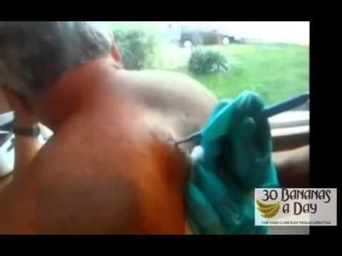 EbooksEuCom's tweet image. Clear ... - #AcneTreatments #ExistingPimples #PimplesProblems #TeaTreeOil #UvRays - ebooks.eu.com/clear-skin-can…