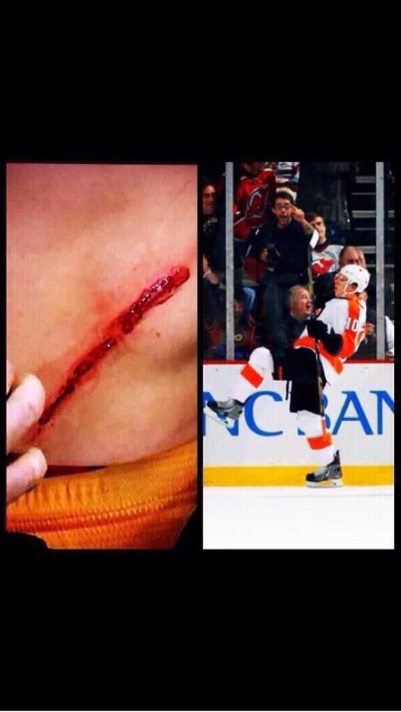 PuckPorn's tweet photo. Schenn took a skate to the stomach and came back and scored the overtime winner. RT if you have respect for Schenn! http://t.co/7UnlyQfpiJ