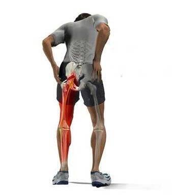 AspireChiro's tweet photo. What causes radiating pain? http://t.co/fUpHWSsf9N http://t.co/x0Q2NexH1H