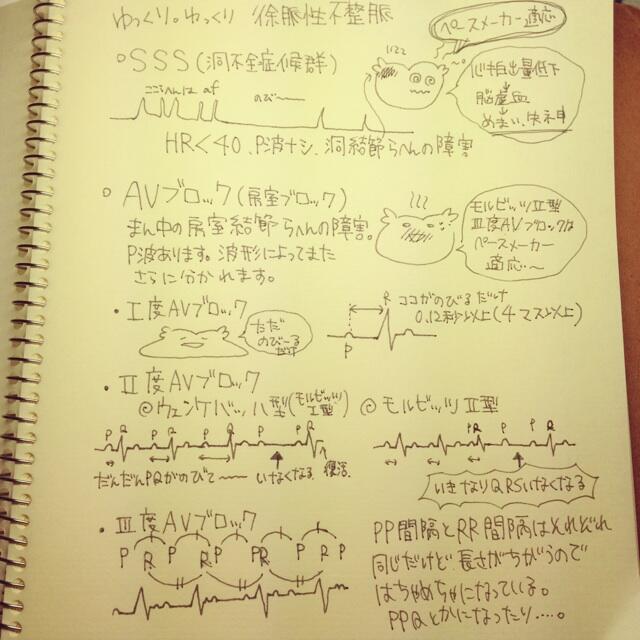 sss様★専用ページ 房室ブロックと洞不全症候群(SSS)の違い-心電図を見分ける