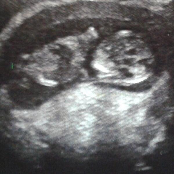 aleycegui's tweet image. Nuestro bbcit@ hermoso@  te amo @shuyortega