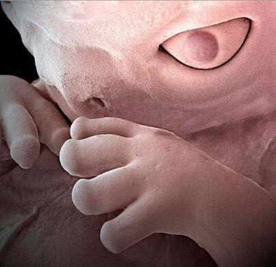 AsapSCIENCE's tweet photo. Amazing electron microscope image of a human foetus. http://t.co/fN5aY5xNWy