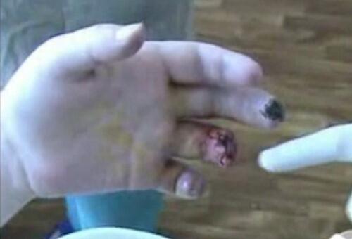 Caramujao_'s tweet photo. fui cortar o cabelo e disse pra moça tira só 3 dedos, olha como ficou http://t.co/AqkyFCe4er