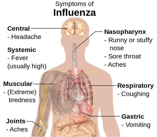 Image result for flu atau influenza