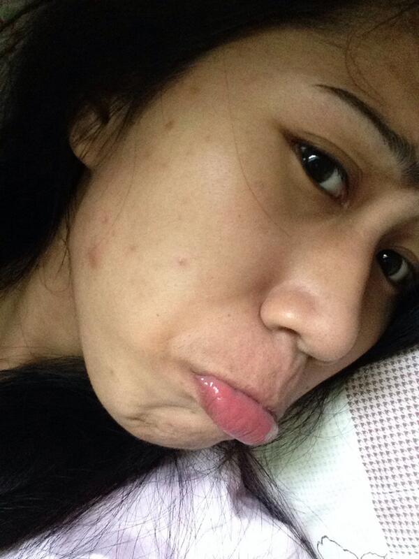 gemmiemoore's tweet image. Putangeeens nga mga pimples hu! Dula kna bwas haa! Poga! Bc ma turn off c Baby 😔 #pimpleproblems