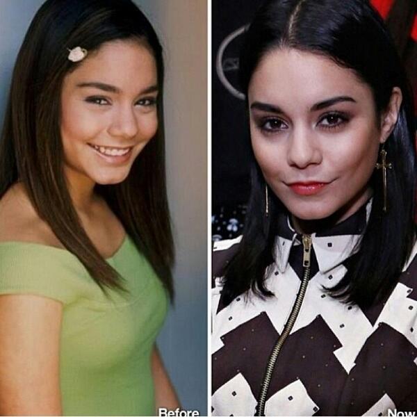 thebeforeandnow's tweet photo. Vanessa Hudgens! http://t.co/PpZQE4L4yn