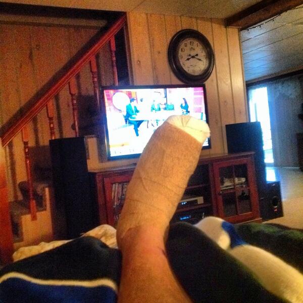 BVT22's tweet image. Surgery yesterday...again! Dr. Found torn ligament capsule in my toe! Pain! #timetorecover