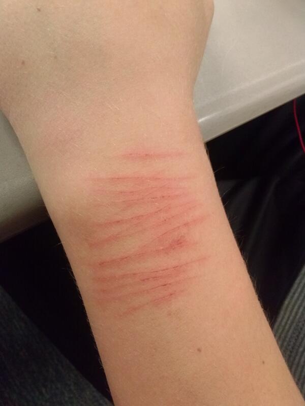 blakepulleyswag's tweet photo. Rough night of cod ghosts so cut myself #codlife #rage #swag #sunnybeach #ThoseWereTheDays #isuck http://t.co/VDemKte4SI