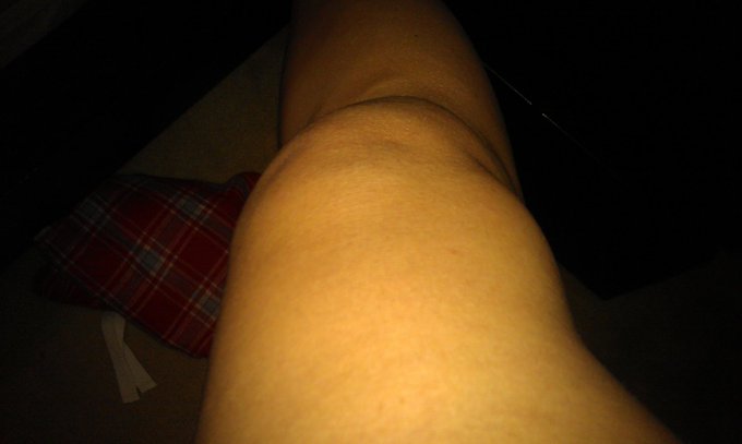 My newly acquired kneecap.... :-/ http://t.co/0ppx1ls3EY<a href="/tag/christmastoy"class="tags"><span>#christmastoy</span></a>