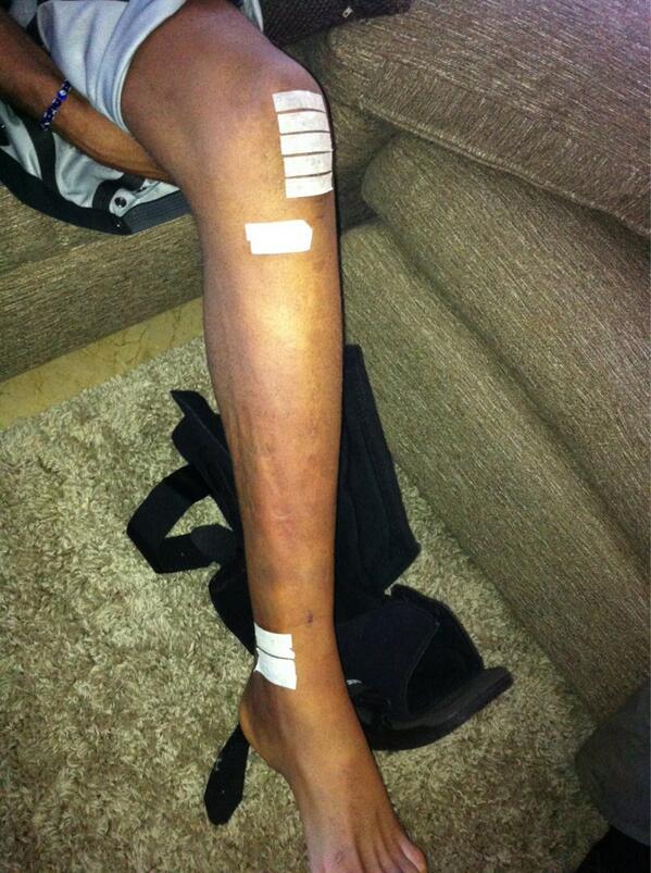 Road to recovery (Anderson Silva) BdpsOLXCUAATiHp
