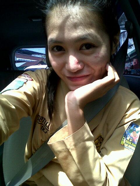 SeptiLP tweet picture