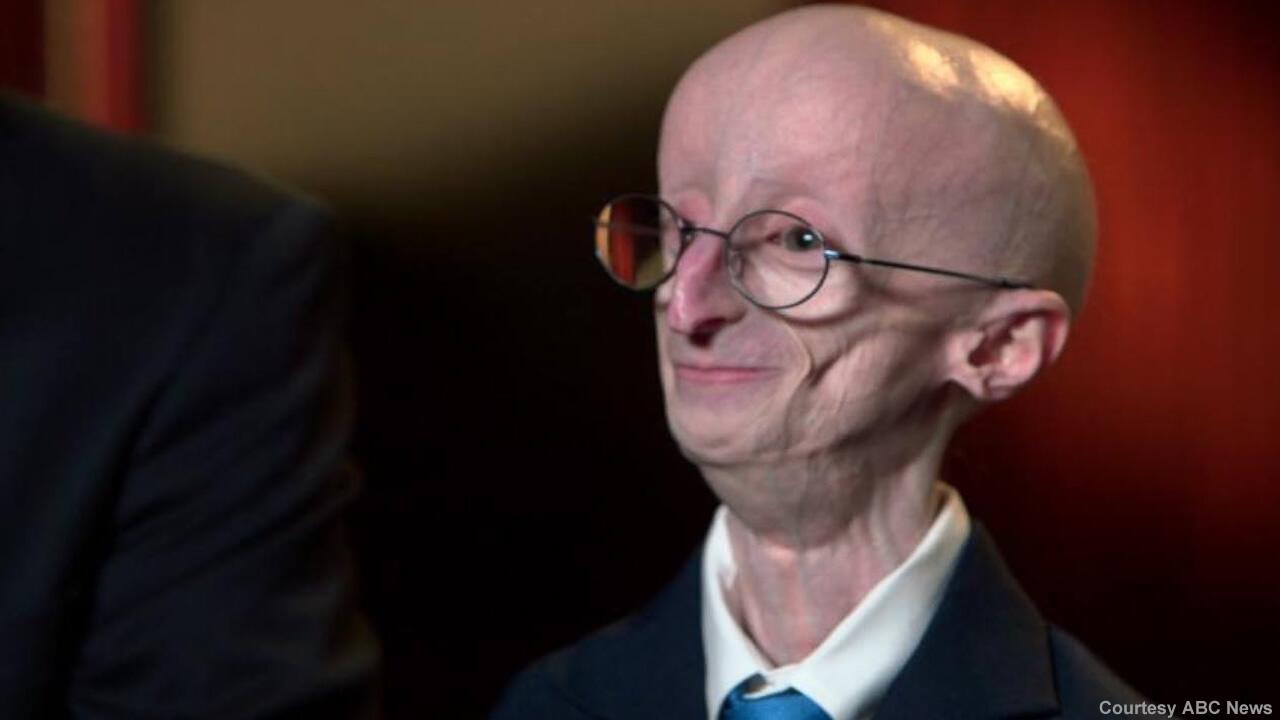 Button disease benjamin Progeria: Causes,