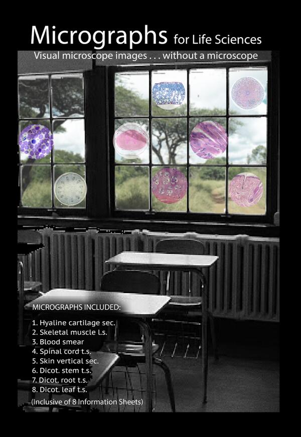 tadpole62's tweet image. #Micrographs for schools without #microscopes . #lifescience #histology #biology #zoology