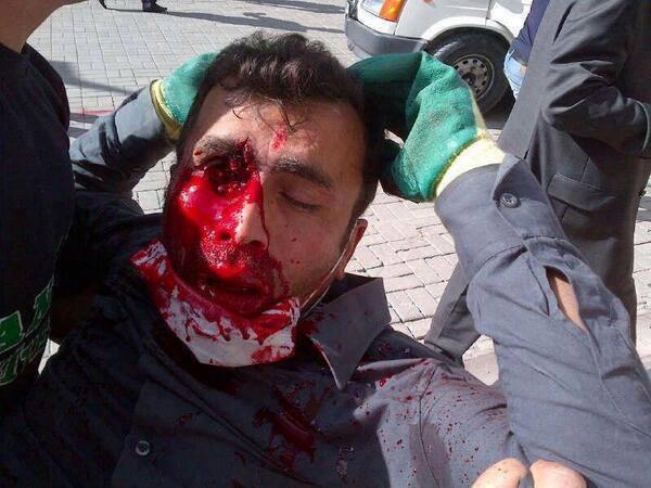 Anticapitalis_'s tweet photo. Esto es lo que hacen las pelotas de goma. La foto es de una manifestación en Turquía. http://t.co/ZSzOpG5PMM